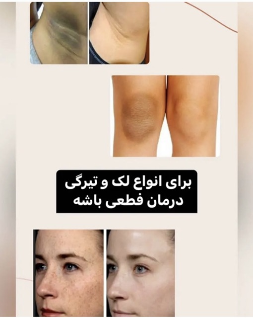 سرم روشن کننده دائمی بدن کد(0233)